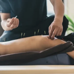 Trigger Points of the Torso & Upper Limbs